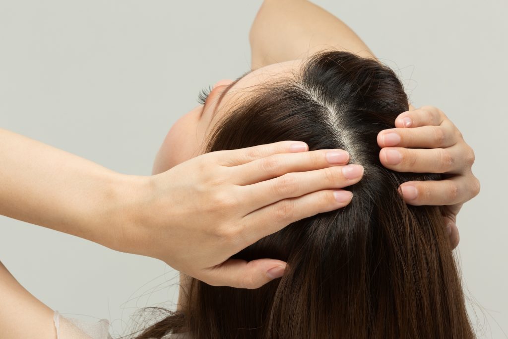 Woman feeling her scalp